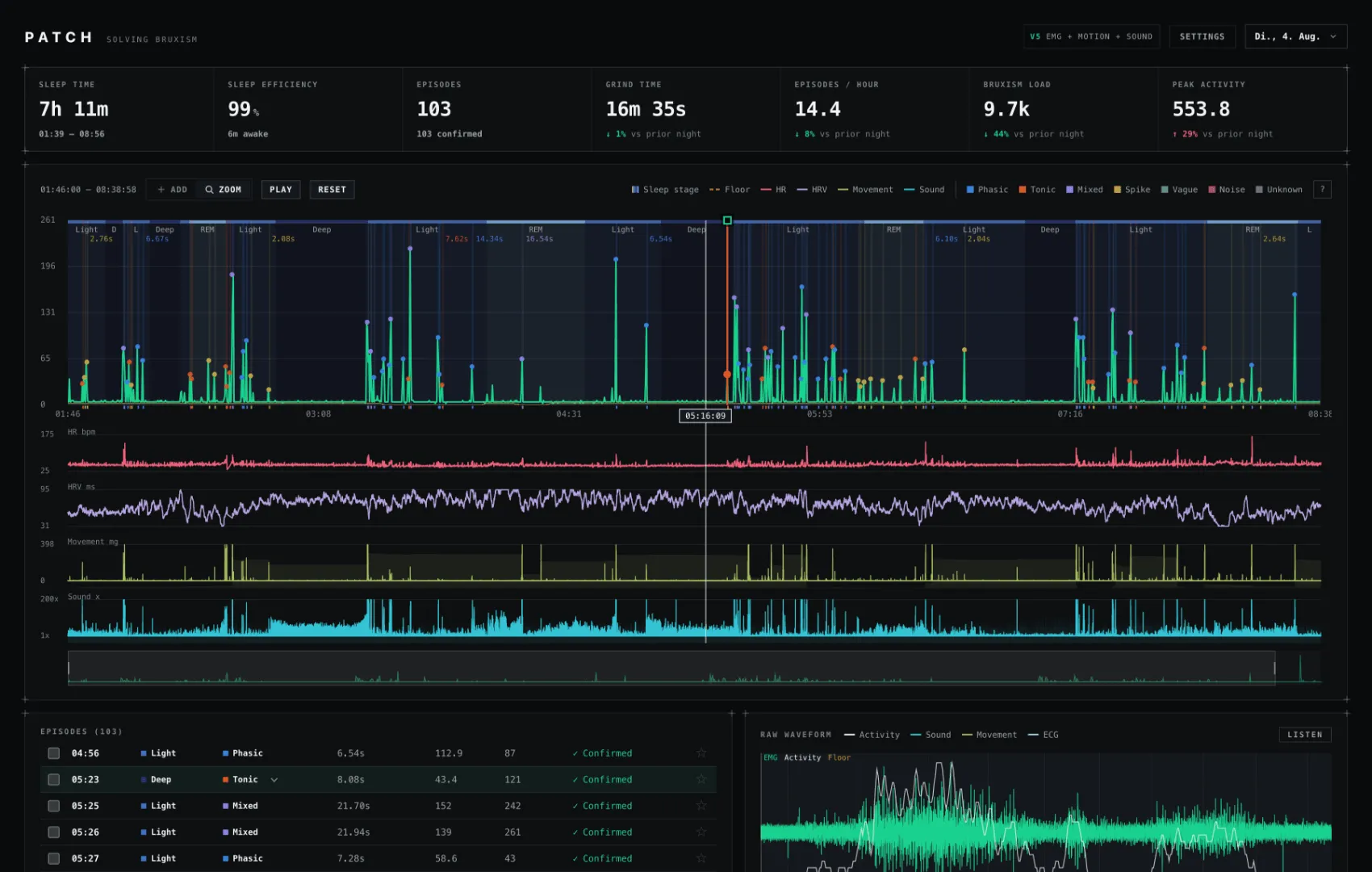 Night review dashboard with a full night of episodes lined up against sleep stages and heart rate